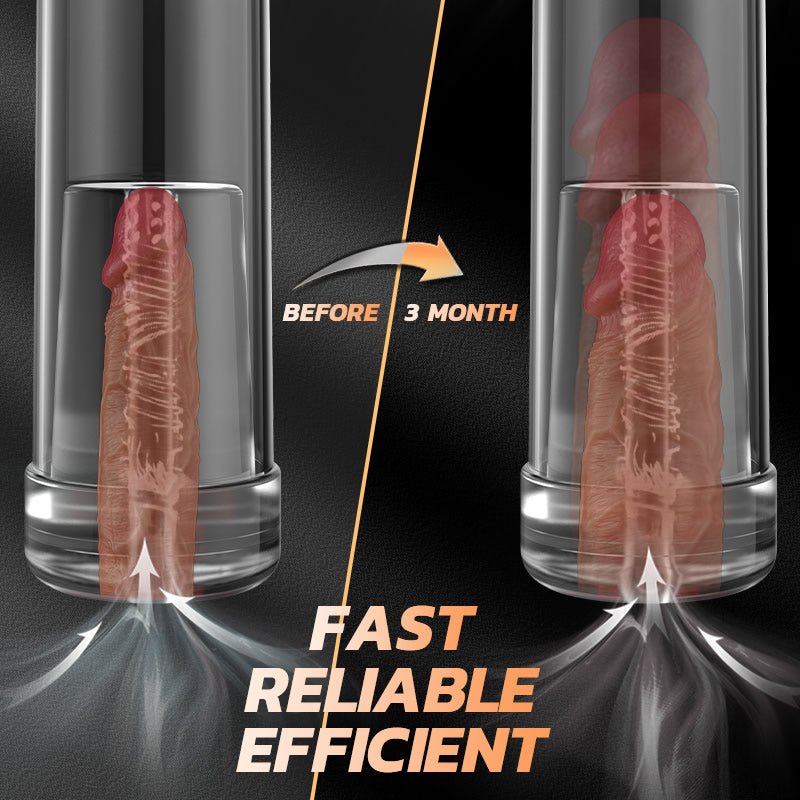 Arno - 2 Modes 6 Levels Transparent Electric Penis Pump or Penis Enlargement Pump - Detachable